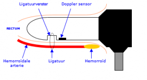 hal-procedure