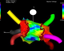 Module elektrofysiologie