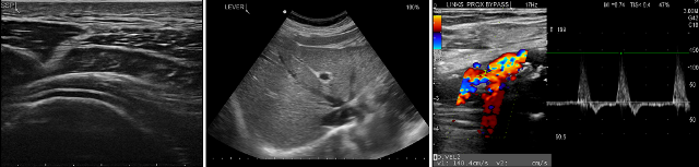 gevogelte Stralend horizon Echografie - Medisch Spectrum Twente