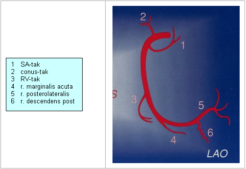 Opnamen RCA hartkatheterisatie