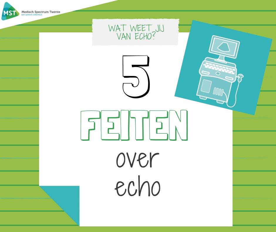 5-feiten-over-echo
