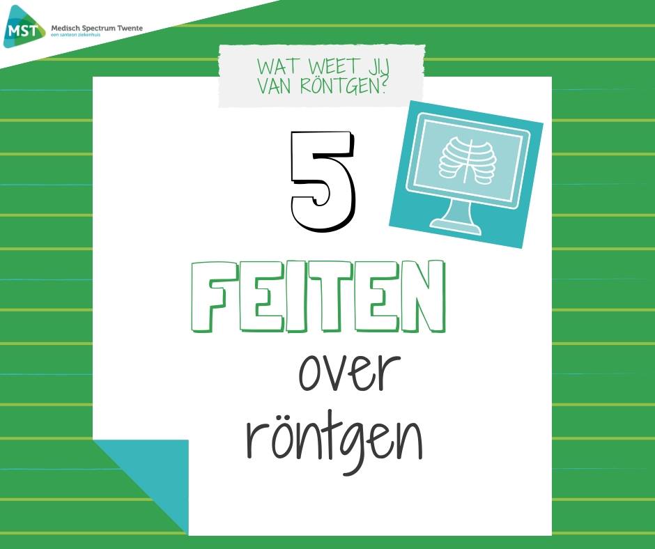 5-feiten-over-rontgen